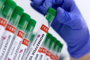 Pakistan : Deuxième décès lié au Mpox et preuve d'une transmission locale