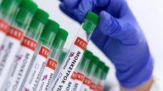 Pakistan : Deuxième décès lié au Mpox et preuve d'une transmission locale